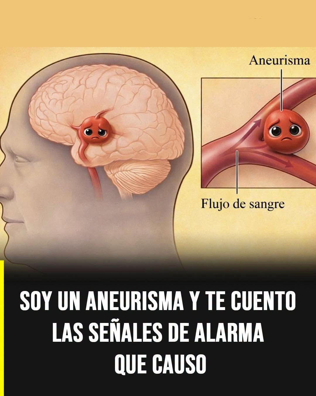 Aneurisma cerebral: qué es, por qué aparece y cuáles son las señales que requieren atención médica