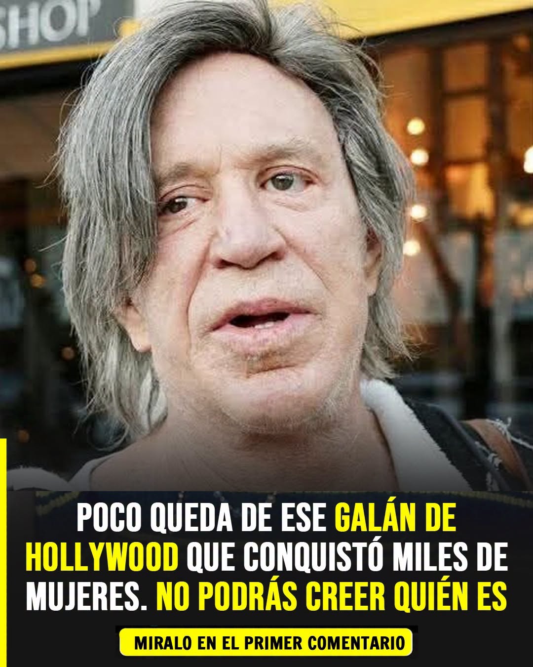 Obsesión por la cirugía estética deforma a ícono de Hollywood